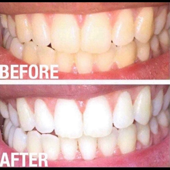New-Three (3)Nuskin Ap24 Whitening Fluoride Toothpaste - Picture 7 of 17